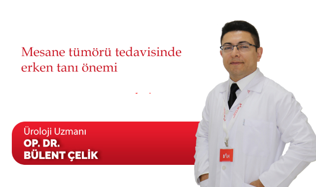 Mesane tümörü tedavisinde erken tanı önemi